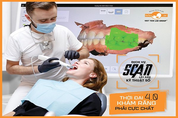 Dịch vụ Scan lấy dấu kỹ thuật số - Công nghệ đột phá mới