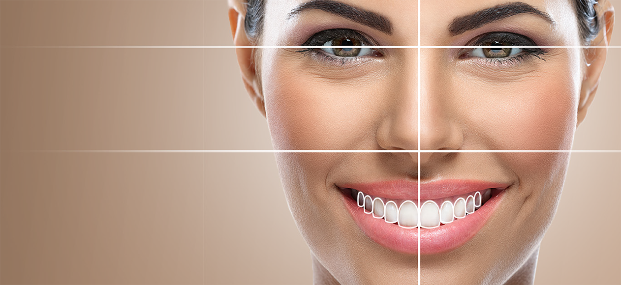 Smile Design