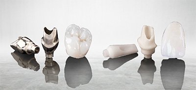 Phục hình toàn sứ trên Implant
