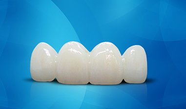 Sứ Zirconia