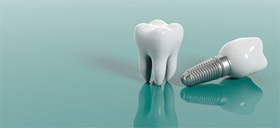 Phục hình sứ bắt vít