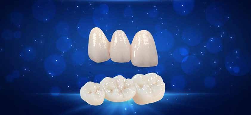 Phục hình Zirconia